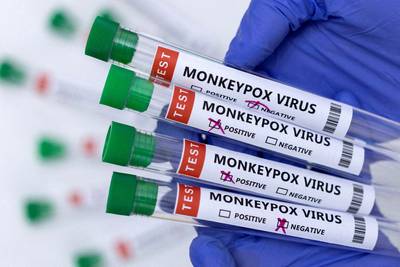 Suiza inicia pacientes para el estudio de la viruela del simio